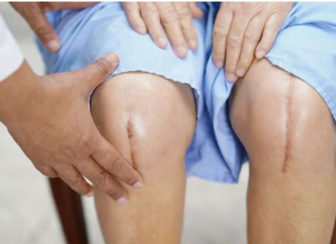 Knee surgery-