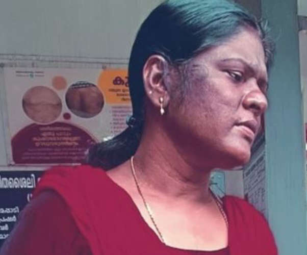 Ashavarkar identified around 100 dead bodies