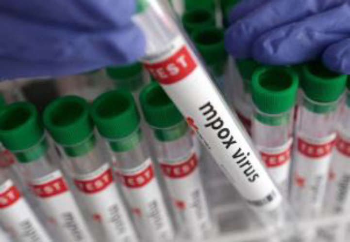 MPox Confirmed in India Young Man Undergoing Treatment