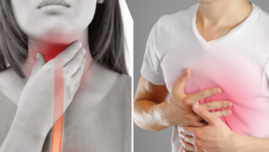 Heartburn and heart attack