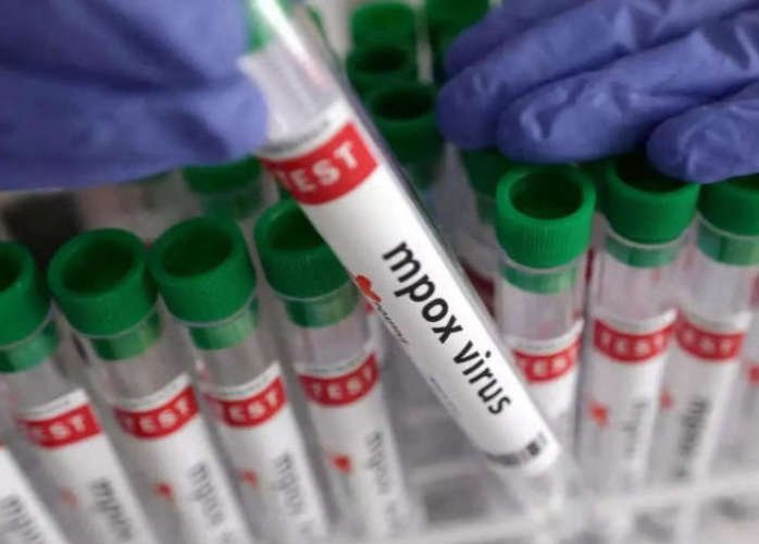 Suspected Monkeypox Case in Alappuzha Person Who Returned from Abroad Shows Symptoms