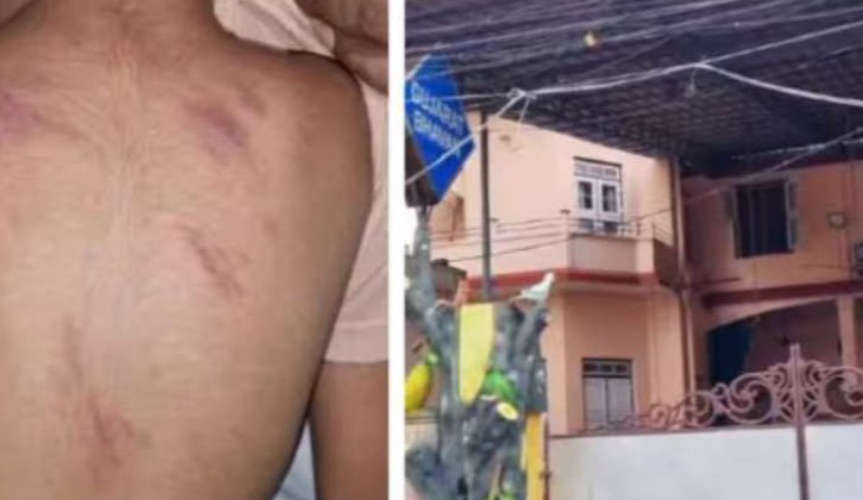 Play School Closed After Teacher Beats 3-Year-Old Student