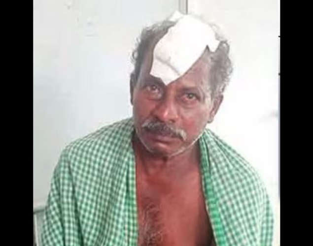 Train Passenger Hurt in Stone Pelting Incident