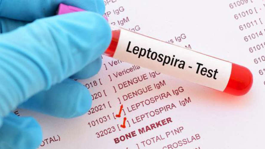 one-death-due-to-leptospirosis-rat-fever-in-thiruvananthapuram