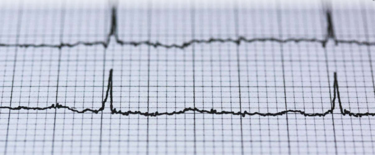 AI can now measure the lifespan of humans