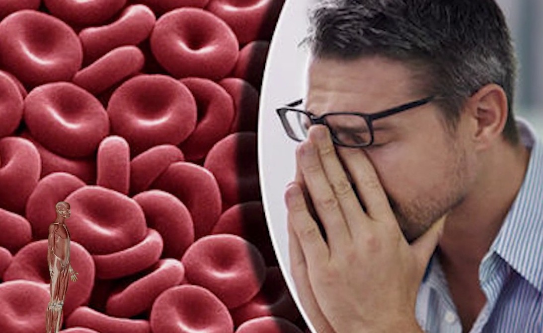  Iron Deficiency Anemia Symptoms and Effects