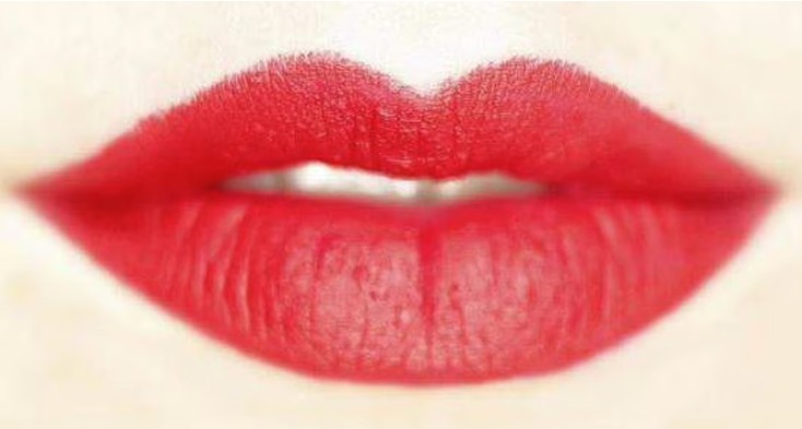 Dark Lips Causes and Why Lip Care Matters