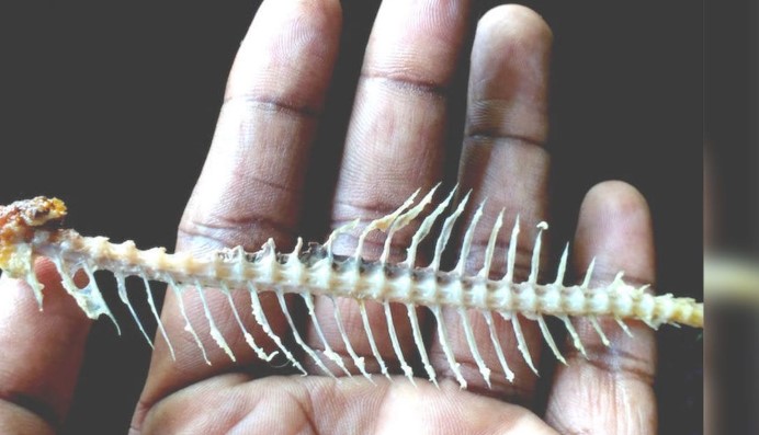 Fish Bone Stuck in Throat Dont PanicHeres What You Can Do Immediately