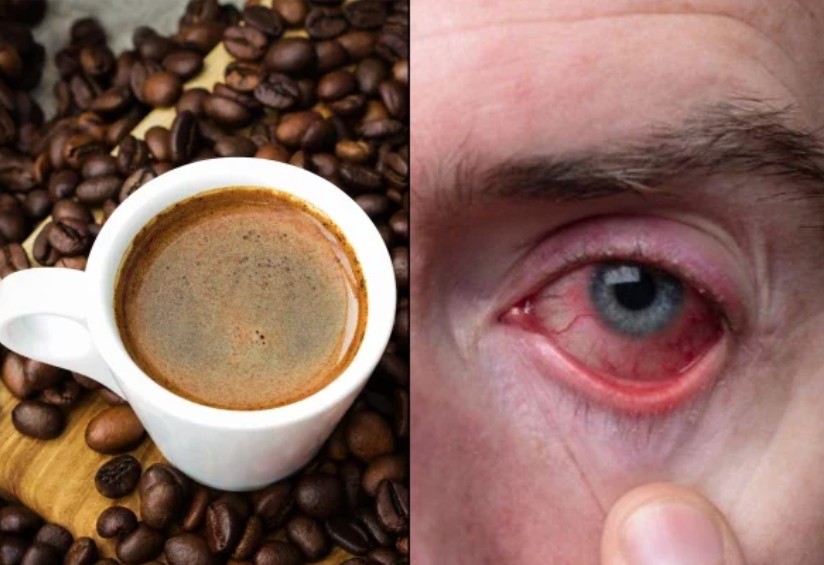Instant Coffee Linked to 700 Higher Blindness Risk Study Warns