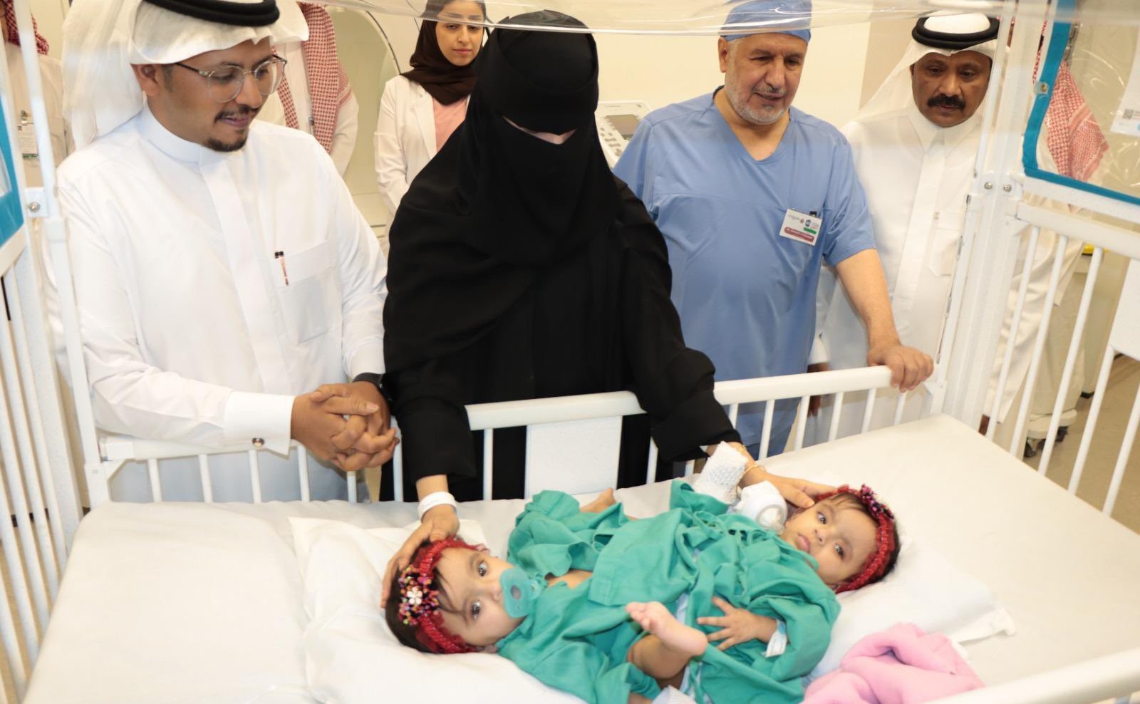 Saudi conjoined twins Yara and Lara successfully separated in 125-hour surgery