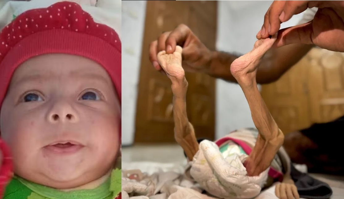 Five-month-old baby dies in mothers arms in Gaza a new victim of starvation crisis