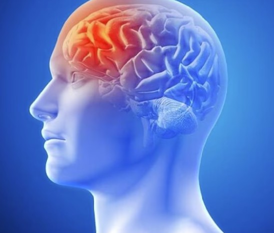 migraine more than just a headache