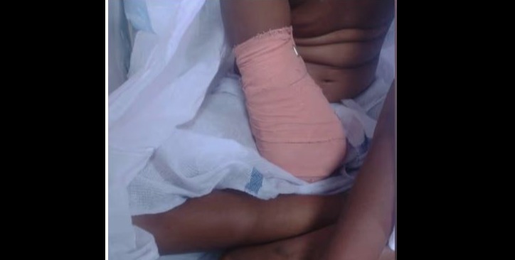 palakkad district hospital medical negligence case 9-year-old girls right hand amputated after playtime fall hospital blames parents for delay