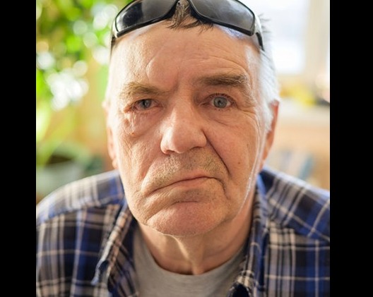 bells palsy causes symptoms and quick recovery guide