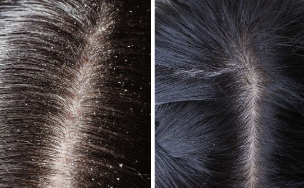  hair health tips balanced diet and essential nutrients