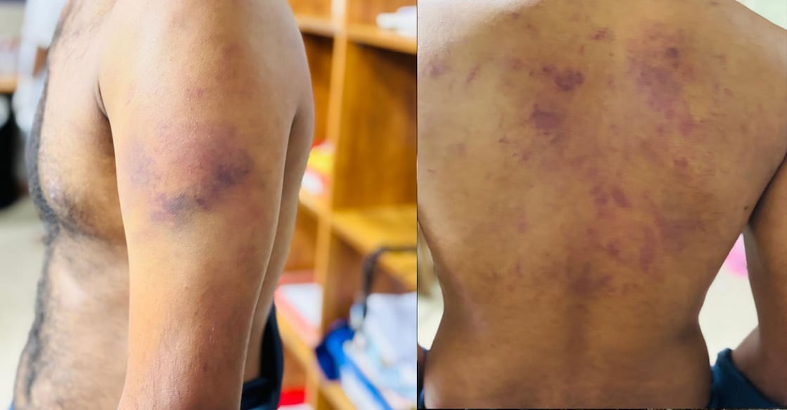 honey trap and attack against differently abled