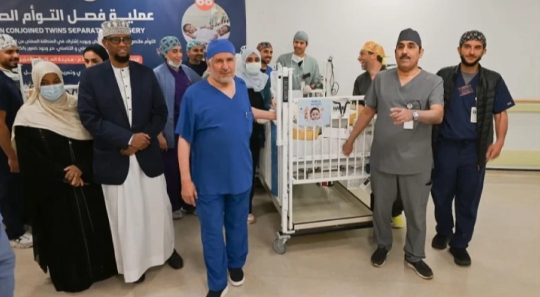 somali conjoined  twins separation surgery riyadh saudi program